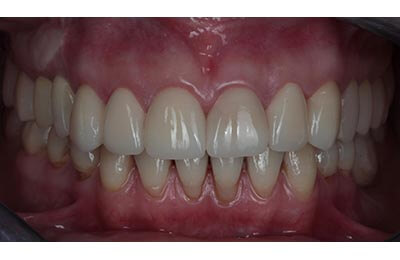 Zahnarztpraxis Dr. Zwanzig: Ästhetische Korrekturen