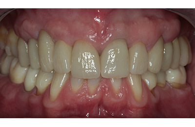 Zahnarztpraxis Dr. Zwanzig: Komplexe Fälle