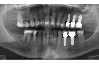 Zahnarztpraxis Dr. Zwanzig: Komplexe Fälle
