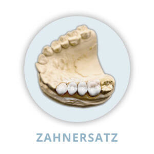 Zahnersatz in Bielefeld